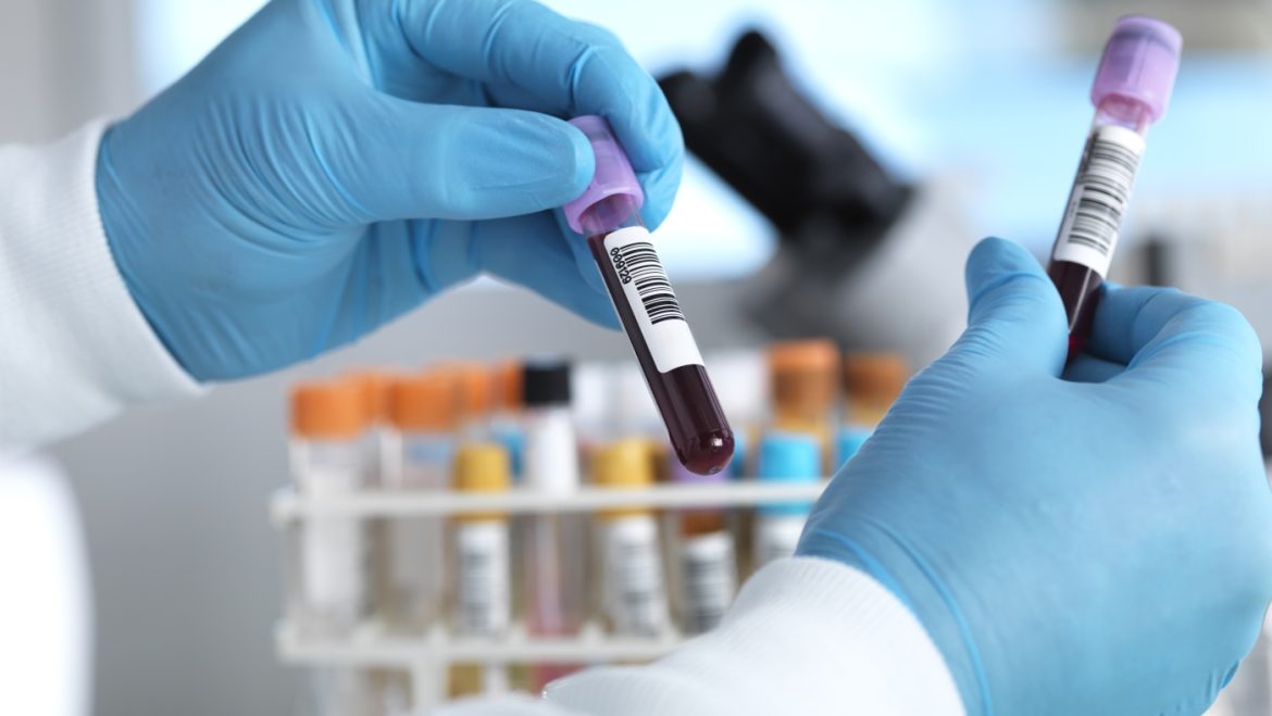 Survey Reveals Growing Interest in Alzheimer’s Testing Among Older Americans