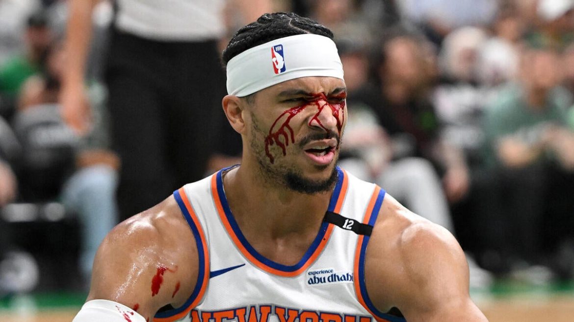 Knicks’ Josh Hart Bloodied After Elbow from Celtics’ Luke Kornet in Game 5
