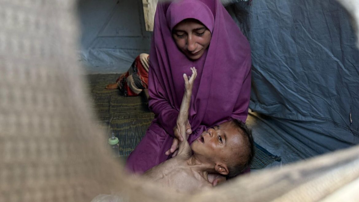 Gaza’s Starving Toddler